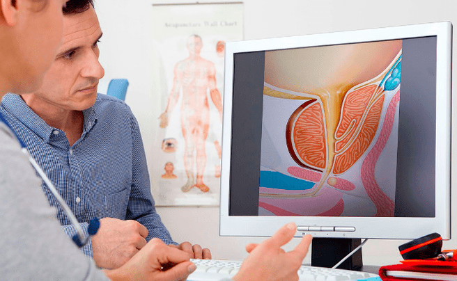 Prostatitis diagnosis